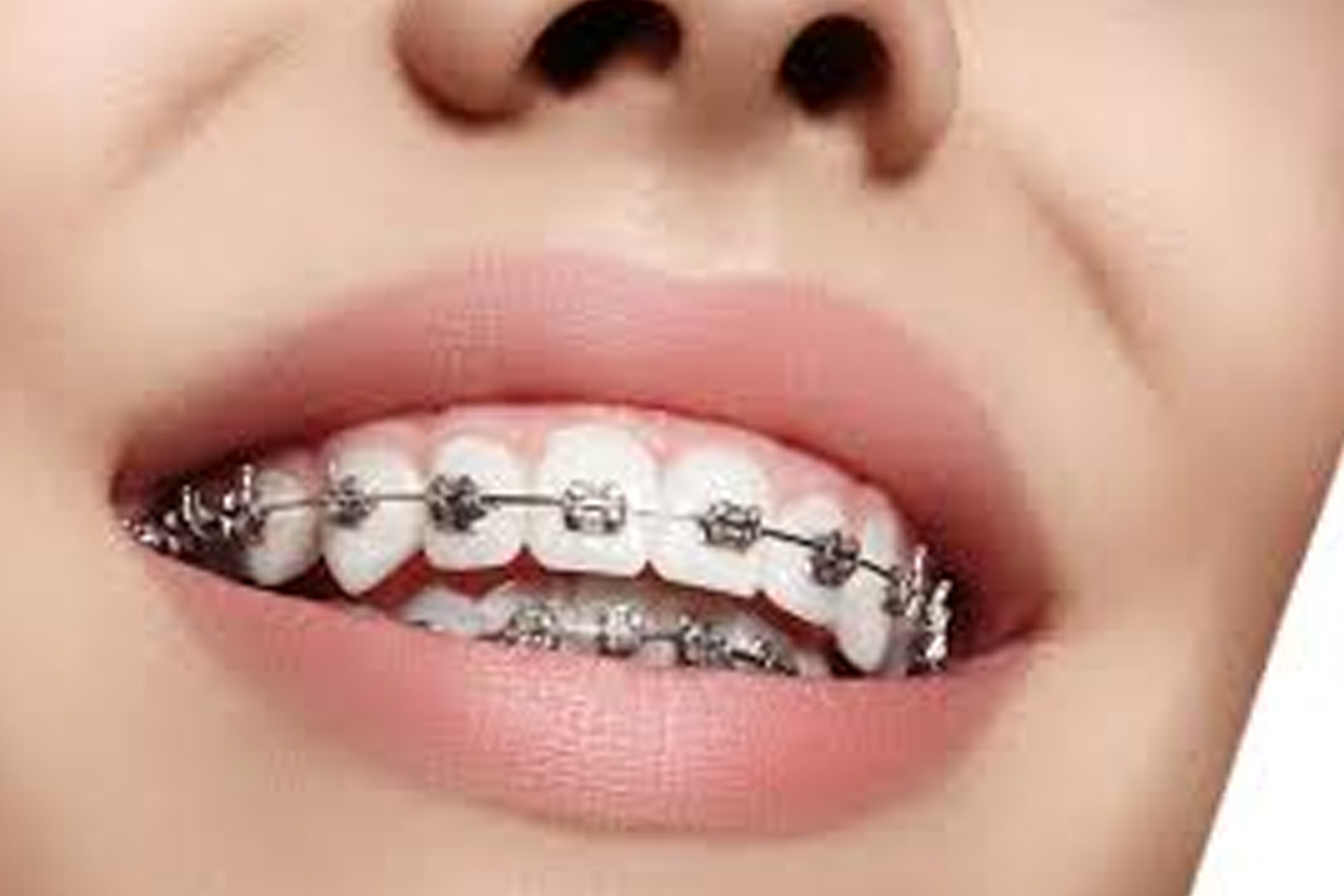 Orthodontics